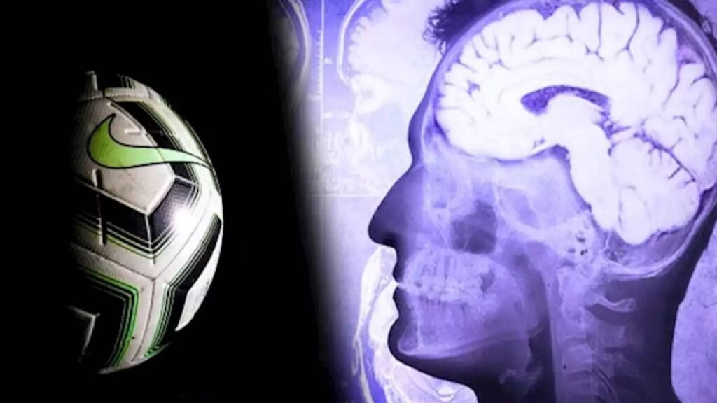 exjugador-murio-de-demencia-por-golpes-del-futbol